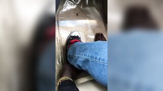 Tasty toes and big sore bunion feet