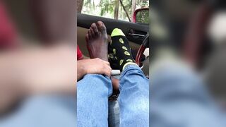 Tasty toes and big sore bunion feet