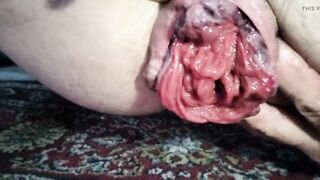 Close Up prolapsing rosebud