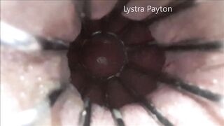 Extreme hole in sissy ass